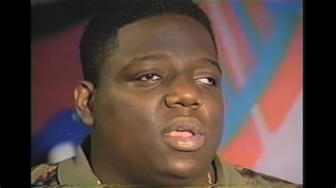 was biggie smalls cross eyed.